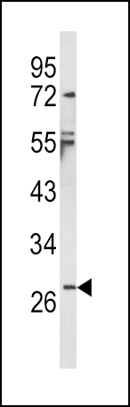 WB - IL1B Antibody (Center) AP8531C