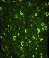 Immunofluorescence analysis of ABI1 Antibody (N-term) with paraffin-embedded human brain tissue . 0.05 mg/ml primary antibody was followed by FITC-conjugated goat anti-rabbit lgG (whole molecule). FITC emits green fluorescence.
