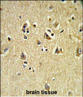 IHC-P - VPS53 Antibody (N-term) AP8546a