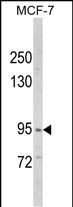 WB - VPS53 Antibody (N-term) AP8546a