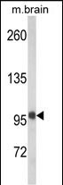 WB - VPS53 Antibody (N-term) AP8546a