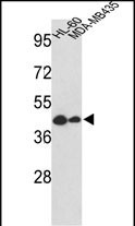 Western blot analysis of GSDMB Antibody (Center) (Cat. #AP8559c) in HL-60, MDA-MB435 cell line lysates (35ug/lane). GSDMB (arrow) was detected using the purified Pab.