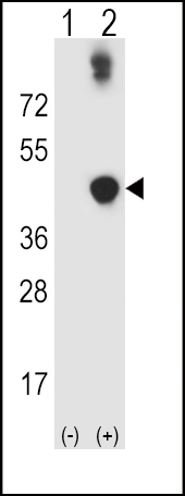 Western blot analysis of ADH5 (arrow) using rabbit polyclonal ADH5 Antibody (Center) (Cat. #AP8562c). 293 cell lysates (2 ug/lane) either nontransfected (Lane 1) or transiently transfected (Lane 2) with the ADH5 gene.