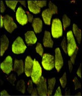 Immunofluorescence analysis of ATP5O Antibody (N-term) with paraffin-embedded human skeletal muscle. 0.05 mg/ml primary antibody was followed by FITC-conjugated goat anti-rabbit lgG (whole molecule). FITC emits green fluorescence.Red counterstaining is PI.
