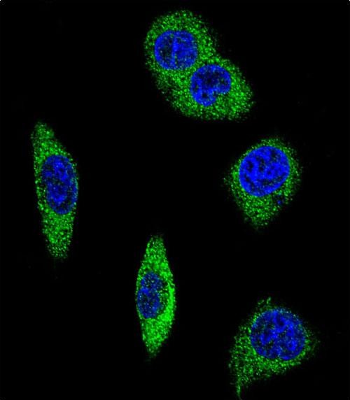Confocal immunofluorescent analysis of ADRA2B Antibody (Center)(Cat#AP8566c) with MDA-MB231 cell followed by Alexa Fluor� 488-conjugated goat anti-rabbit lgG (green). DAPI was used to stain the cell nuclear (blue).