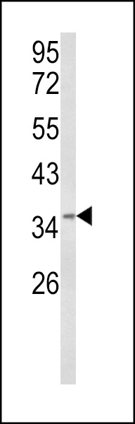 WB - HSPC142 Antibody (Center) AP8573c