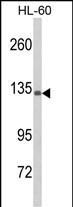 Western blot analysis of C5 Antibody (N-term) (Cat. #AP8577a) in HL-60 cell line lysates (35ug/lane). C5 (arrow) was detected using the purified Pab.(2ug/ml)
