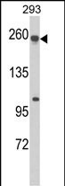 Western blot analysis of ABCC5 Antibody (Center) (Cat. #AP8578c) in 293 cell line lysates (35ug/lane). ABCC5 (arrow) was detected using the purified Pab.(2ug/ml)