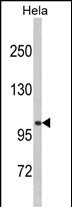 Western blot analysis of CASK (Center K227) (Cat. #AP7212c) in Hela cell line lysates (35ug/lane).CASK (arrow) was detected using the purified Pab.