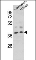 Western blot analysis of EN2 Antibody (C-term) (Cat. #AP7457f) in mouse cerebellum, brain tissue lysates (35ug/lane). EN2 (arrow) was detected using the purified Pab.