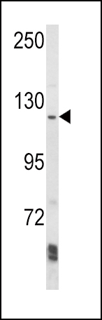 Western blot analysis of AAK1 Antibody (N-term) (Cat. #AP7861a) in Ramos cell line lysates (35ug/lane). AAK1 (arrow) was detected using the purified Pab.