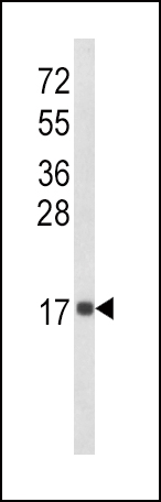 WB - IL8 Antibody (C-term) AP8612B