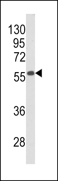 Western blot analysis of Beclin1-BH3 Domain Antibody (Cat. #AP8653a) in mouse stomach tissue lysates (35ug/lane). BECN1 (arrow) was detected using the purified Pab.