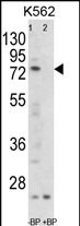 WB - FLCN Antibody (C-term) AP8658b