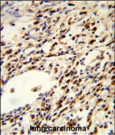 IHC-P - FLCN Antibody (Center) AP8658c