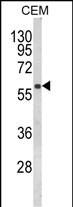 WB - FLCN Antibody (Center) AP8658c