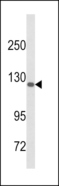 Western blot analysis of DSC1 Antibody (C-term) (Cat. #AP8666b) in A375 cell line lysates (35ug/lane). DSC1 (arrow) was detected using the purified Pab.