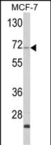 Western blot analysis of ZYG11A Antibody (N-term) (Cat. #AP8676a) in MCF-7 cell line lysates (35ug/lane). ZYG11A (arrow) was detected using the purified Pab.