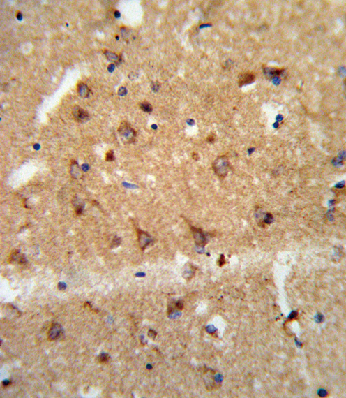 Formalin-fixed and paraffin-embedded human brain tissue reacted with GDNF Antibody (N-term), which was peroxidase-conjugated to the secondary antibody, followed by DAB staining. This data demonstrates the use of this antibody for immunohistochemistry; clinical relevance has not been evaluated.
