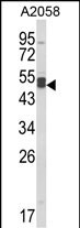 Western blot analysis of AGPAT3 Antibody (Center) (Cat. #AP8686c) in A2058 cell line lysates (35ug/lane). AGPAT3 (arrow) was detected using the purified Pab.