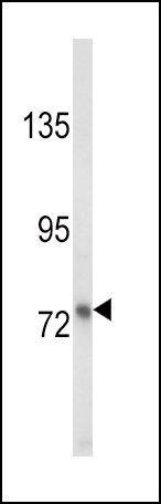 Western blot analysis of LTF Antibody (Cat. #AP8698a) in MDA-MB231 cell line lysates (35ug/lane). LTF (arrow) was detected using the purified Pab.