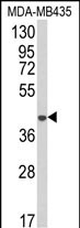 Western blot analysis of AGPAT4 Antibody (Center) (Cat. #AP8705c) in MDA-MB435 cell line lysates (35ug/lane). AGPAT4 (arrow) was detected using the purified Pab.