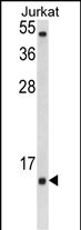 WB - SOD1 Antibody (Center) AP8733c