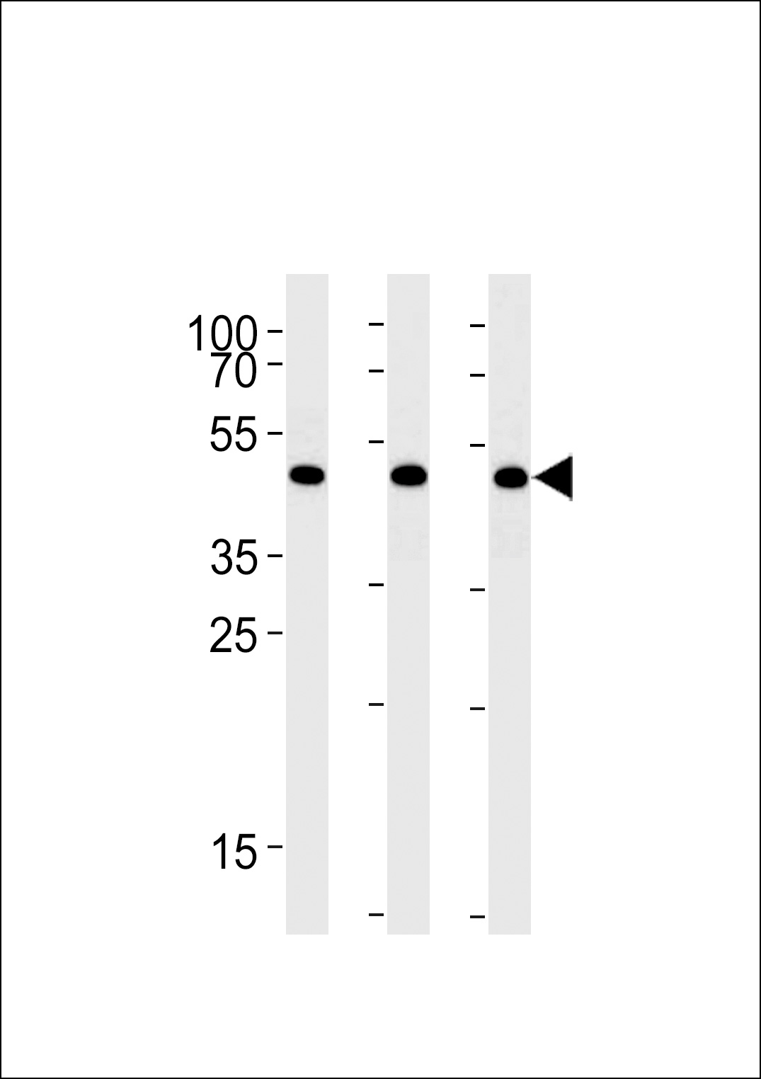BAT1 Antibody (C-term) (Cat. #AP8740b) western blot analysis in A431,Hela,Jurkat cell line lysates (35ug/lane).This demonstrates the BAT1 antibody detected the BAT1 protein (arrow).
