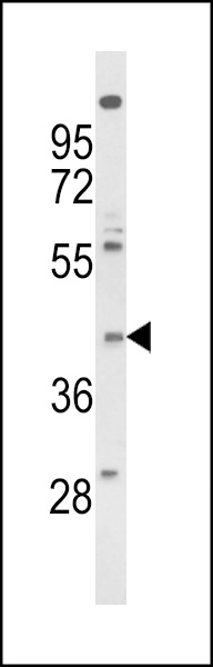 Western blot analysis of FPRL2 Antibody (Center) (Cat. #AP8793c) in NCI-H460 cell line lysates (35ug/lane). FPRL2 (arrow) was detected using the purified Pab.