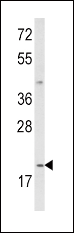 Western blot analysis of IL12A Antibody (C-term) (Cat. #AP8796b) in MDA-MB231 cell line lysates (35ug/lane). IL12A (arrow) was detected using the purified Pab.