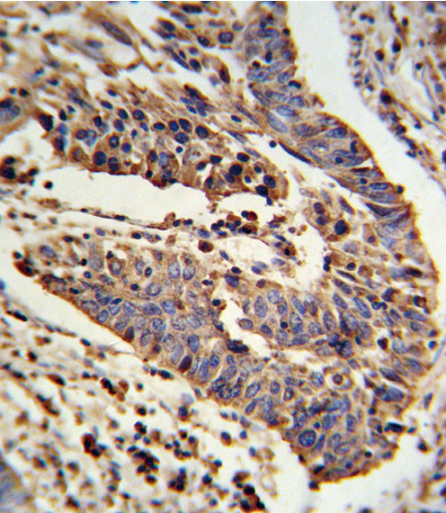 IHC-P - SCNN1A Antibody (Center) AP8804C