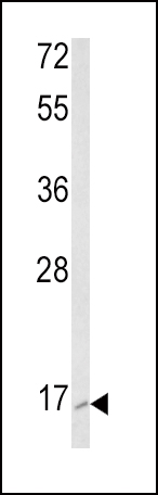 Western blot analysis of RAC2 Antibody (C-term) (Cat. #AP8839b) in K562 cell line lysates (35ug/lane). RAC2 (arrow) was detected using the purified Pab.