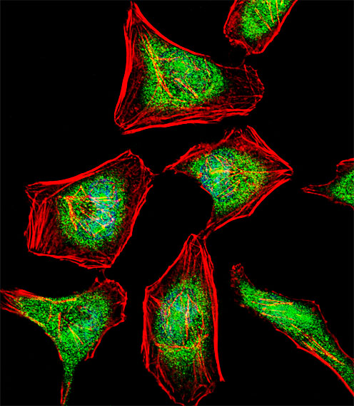 Fluorescent confocal image of Hela cell stained with ATF7 Antibody (N-term)(Cat#AP8844a).Hela cells were fixed with 4% PFA (20 min), permeabilized with Triton X-100 (0.1%, 10 min), then incubated with ATF7 primary antibody (1:25, 1 h at 37?). For secondary antibody, Alexa Fluor� 488 conjugated donkey anti-rabbit antibody (green) was used (1:400, 50 min at 37?).Cytoplasmic actin was counterstained with Alexa Fluor� 555 (red) conjugated Phalloidin (7units/ml, 1 h at 37?). Nuclei were counterstained with DAPI (blue) (10 �g/ml, 10 min).ATF7 immunoreactivity is localized to Nucleus and Cytoplasm significantly.