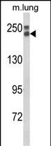 Western blot analysis of COL18A1 Antibody (N-term) (Cat. #AP8852a) in mouse lung tissue lysates (35ug/lane). COL18A1 (arrow) was detected using the purified Pab.