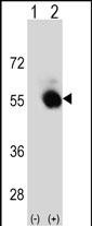 WB - SELENBP1 Antibody (C-term) AP8869b
