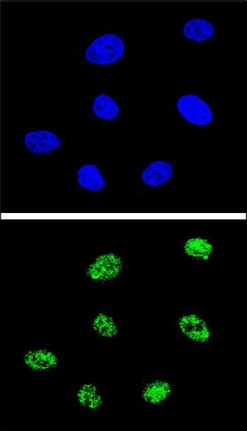 Confocal immunofluorescent analysis of TP73 Antibody (Center) (Cat. #AP8881c) with 293 cell followed by Alexa Fluor� 488-conjugated goat anti-rabbit lgG (green).DAPI was used to stain the cell nuclear (blue).