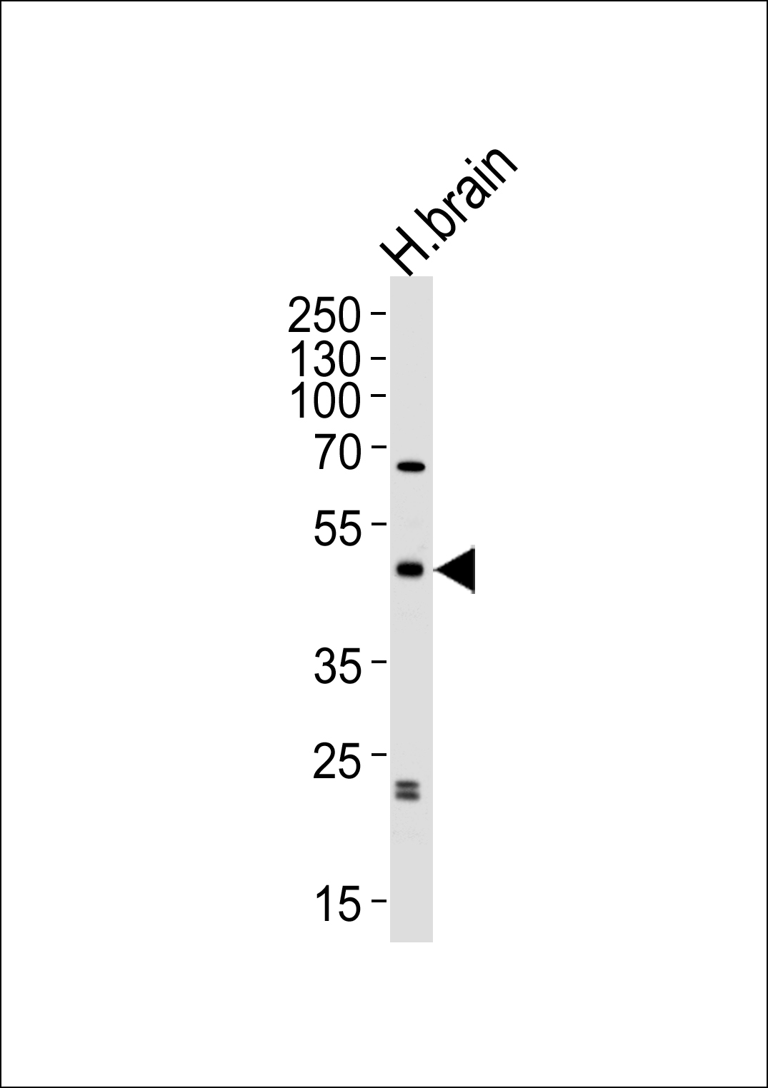 Western blot analysis of lysate from human brain tissue lysate, using ABHD12 Antibody (N-term)(Cat. #AP8904a). AP8904a was diluted at 1:1000 at each lane. A goat anti-rabbit IgG H&L(HRP) at 1:5000 dilution was used as the secondary antibody. Lysate at 35ug per lane. 