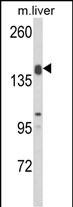 Western blot analysis of ADAMTS18 Antibody (C-term) (Cat. #AP8906b) in mouse liver tissue lysates (35ug/lane). ADAMTS18 (arrow) was detected using the purified Pab.