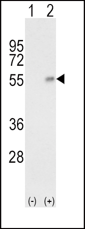 Western blot analysis of HP (arrow) using rabbit polyclonal HP Antibody (Center) (Cat. #AP8929c). 293 cell lysates (2 ug/lane) either nontransfected (Lane 1) or transiently transfected with the HP gene (Lane 2) .