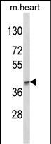 Western blot analysis of LMX1B Antibody (Center) (Cat. #AP8935c) in mouse heart tissue lysates (35ug/lane). LMX1B (arrow) was detected using the purified Pab.