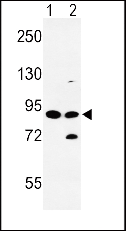 Western blot analysis of SLC8A1 Antibody (Center) (Cat. #AP8939c) in HL-60(lane 1), K562(lane 2) cell line lysates (35ug/lane). SLC8A1 (arrow) was detected using the purified Pab.