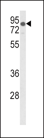 Western blot analysis of LDLR Antibody (Center) (Cat. #AP8960c) in mouse lung tissue lysates (35ug/lane). LDLR (arrow) was detected using the purified Pab.