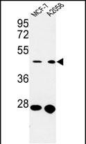 Western blot analysis of CDC37 Antibody (Center) (Cat. #AP8965c) in MCF-7, A2058 cell line lysates (35ug/lane). CDC37 (arrow) was detected using the purified Pab.