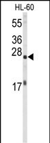 Western blot analysis of EIF4E Antibody (Cat. #AP1954b) in HL-60 cell line lysates (35ug/lane). EIF4E (arrow) was detected using the purified Pab.