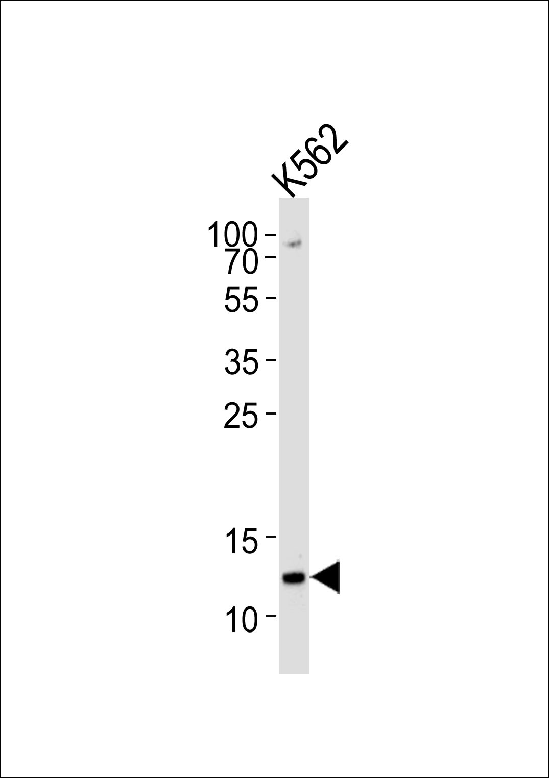 Western blot analysis of lysate from K562 cell line, using H4 Antibody (K20)(Cat. #AP3674a). AP3674a was diluted at 1:1000 at each lane. A goat anti-rabbit IgG H&L(HRP) at 1:5000 dilution was used as the secondary antibody. Lysate at 35ug per lane. 