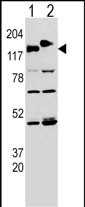Western blot analysis of CLASP (arrow) using rabbit polyclonal CLASP Antibody (Y1019) (Cat. #AP9035a). 293 cell lysates transfected with the ACADL gene (Lane 1) and with the GFP-CLASP (Lane 2).