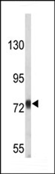 Western blot analysis of APP-pY756 (Cat. #AP9053a) in T47D cell line lysates (35ug/lane). APP (arrow) was detected using the purified Pab.