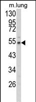 WB - EFEMP1 Antibody (N-term) AP9095a