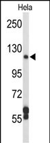 Western blot analysis of DPP8 Antibody (N-term) (Cat. #AP6506a) in Hela cell line lysates (35ug/lane). DPP8 (arrow) was detected using the purified Pab.