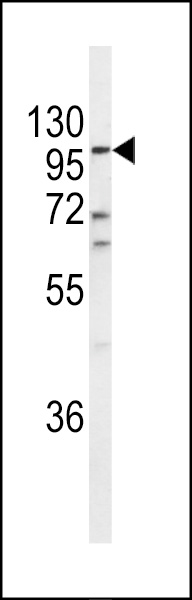 Western blot analysis of ECE-1 Antibody (C-term) (Cat. #AP6855b) in A2058 cell line lysates (35ug/lane). ECE-1 (arrow) was detected using the purified Pab.
